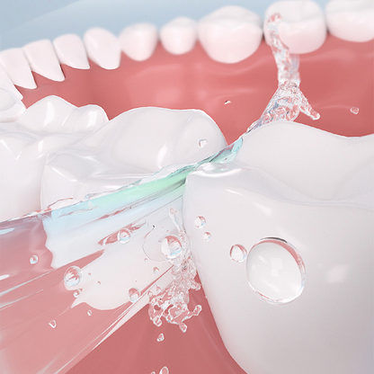 DentLock® UltraBond Premium Denture Adhesive 🔥 FDA Certified (Clinically Proven 4-Day Hold for Secure, Comfortable & Zinc-Free Denture Fit 🦷)